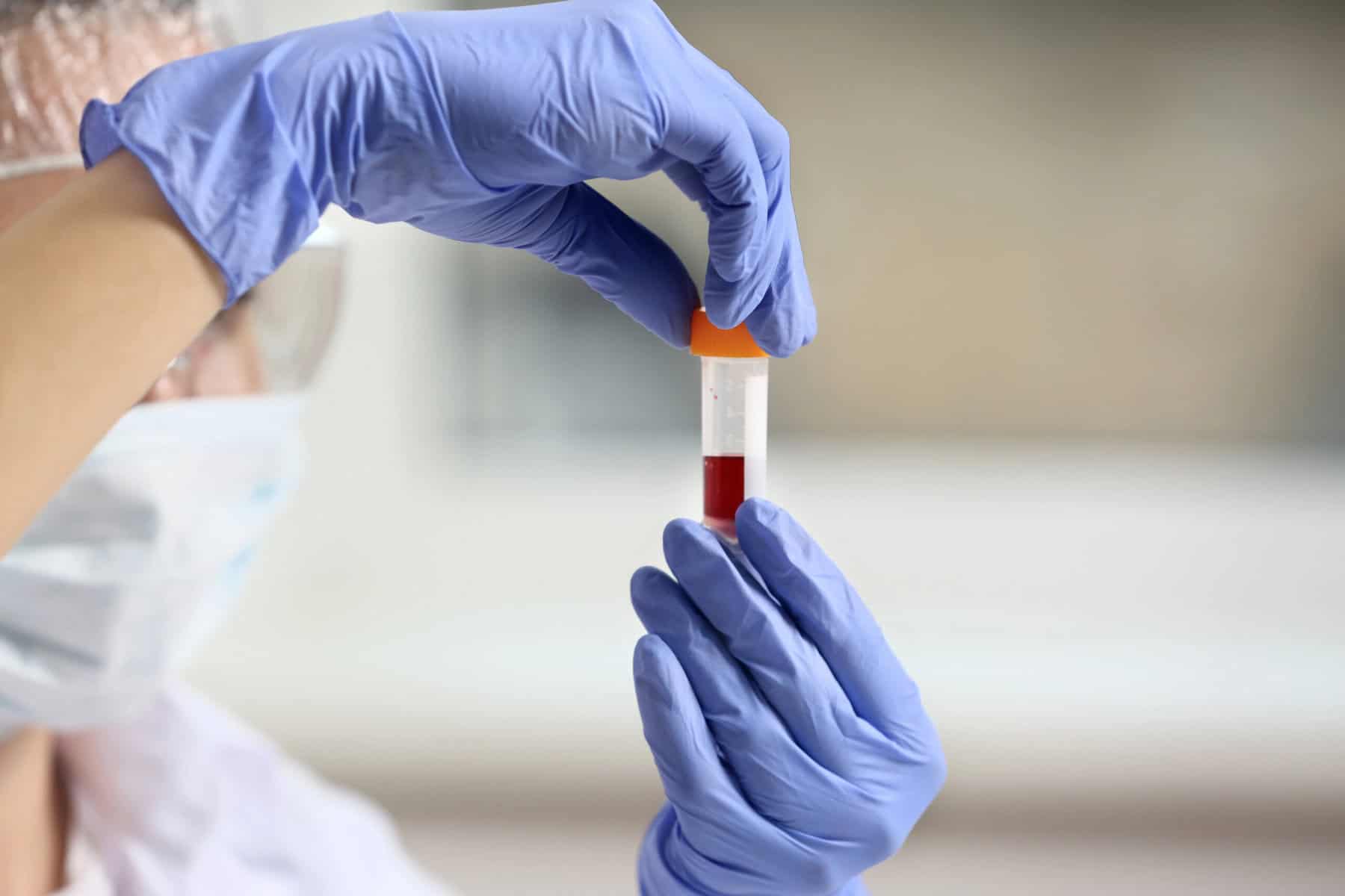 Vial with blood sample being held by gloved hands in a medical lab setting.