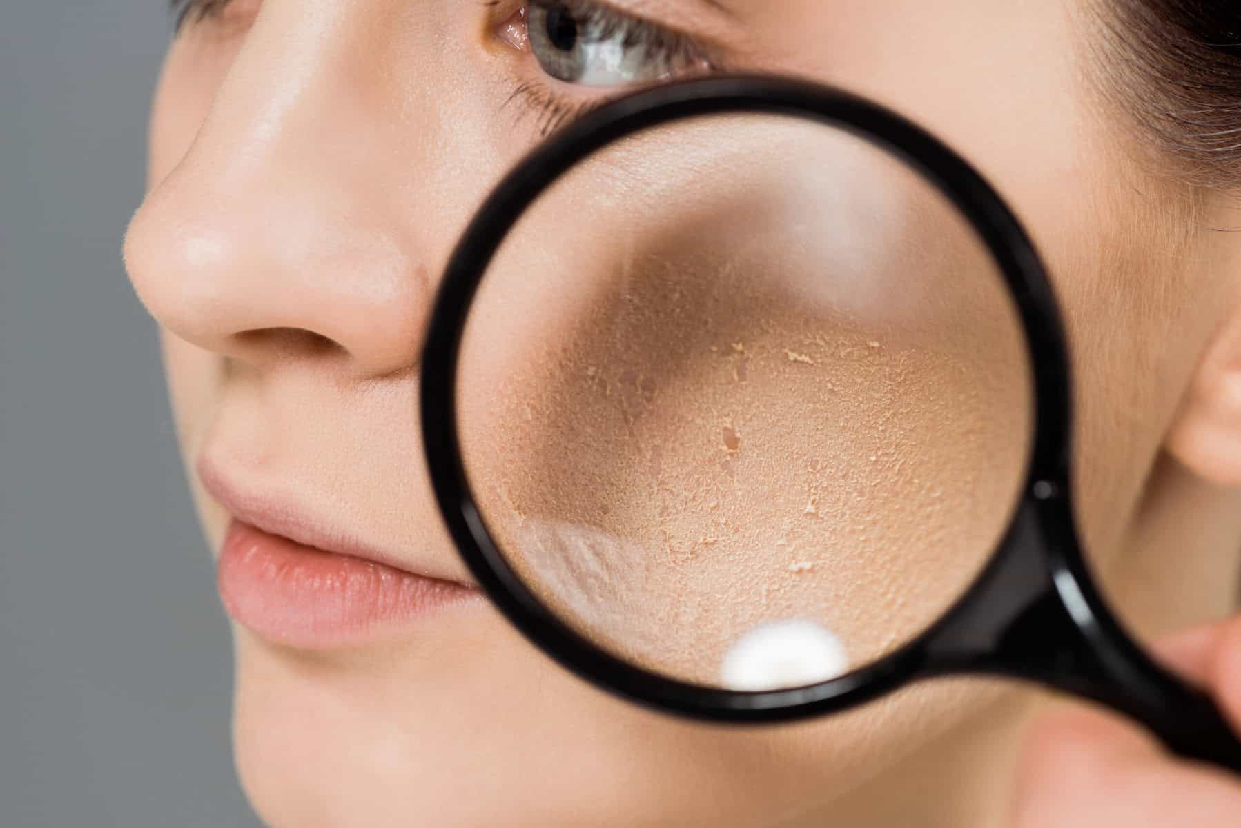 Skin care magnified view, close-up of person's face with magnifying glass, focusing on skin texture and pores.